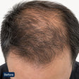 Hair Activation Complex