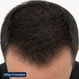 Hair Activation Complex