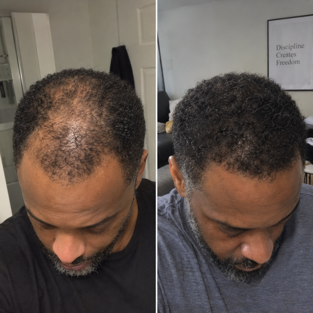 American BioLabs customer result