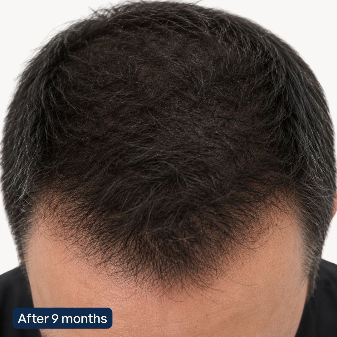 Hair Activation Complex