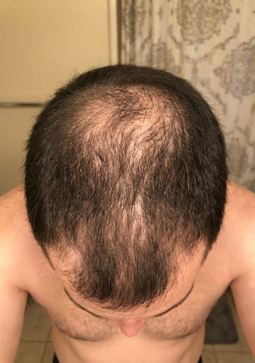 Before photo of Tom B., 37