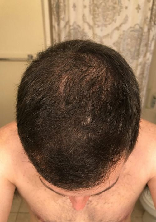 After photo of Tom B., 37