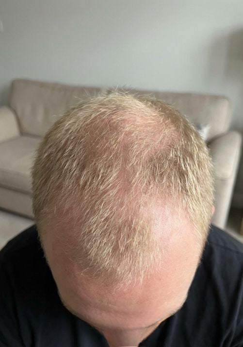 Before photo of Michael R., 49