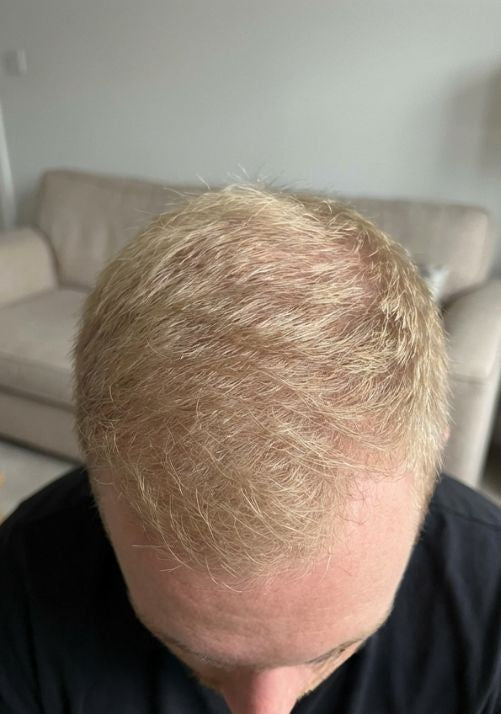 After photo of Michael R., 49