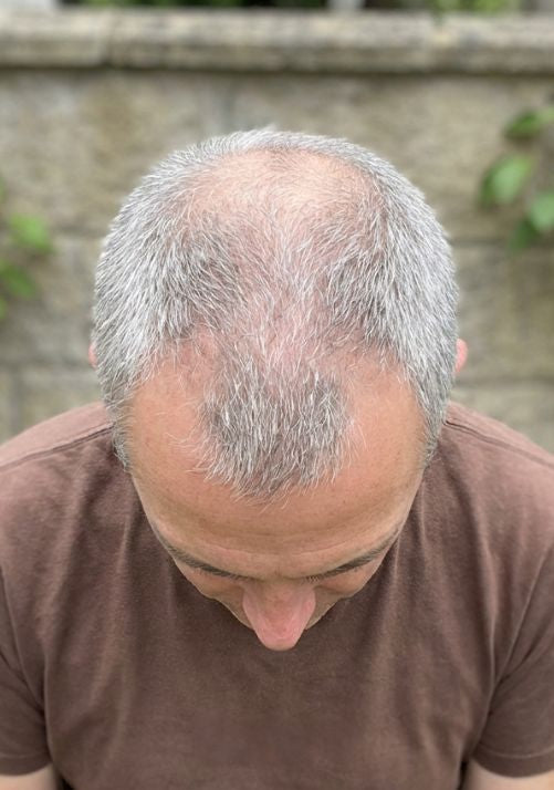 Before photo of Marcus D., 51