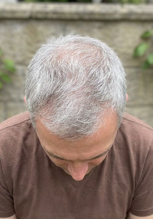After photo of Marcus D., 51