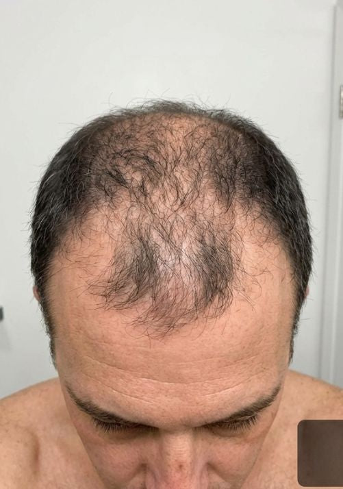 Before photo of James T., 54