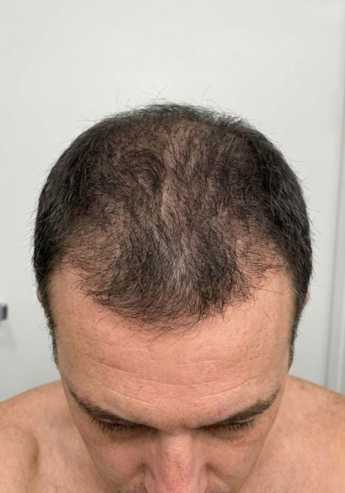 After photo of James T., 54