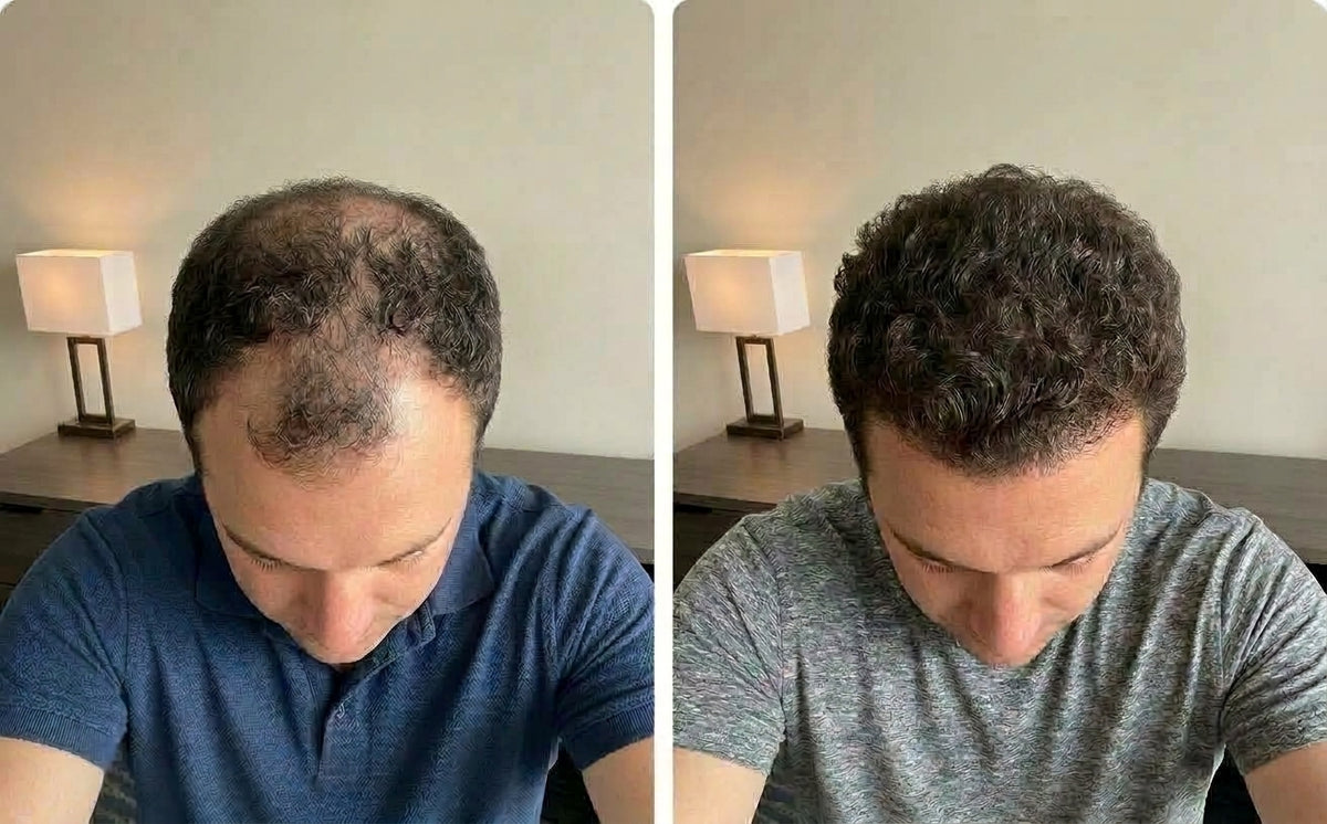 Marcus T., 34
