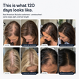 HairGrowth MicroNeedling Solution Serum for Women