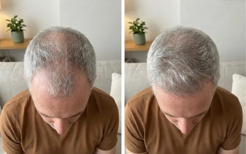 Brian H., 57 before and after