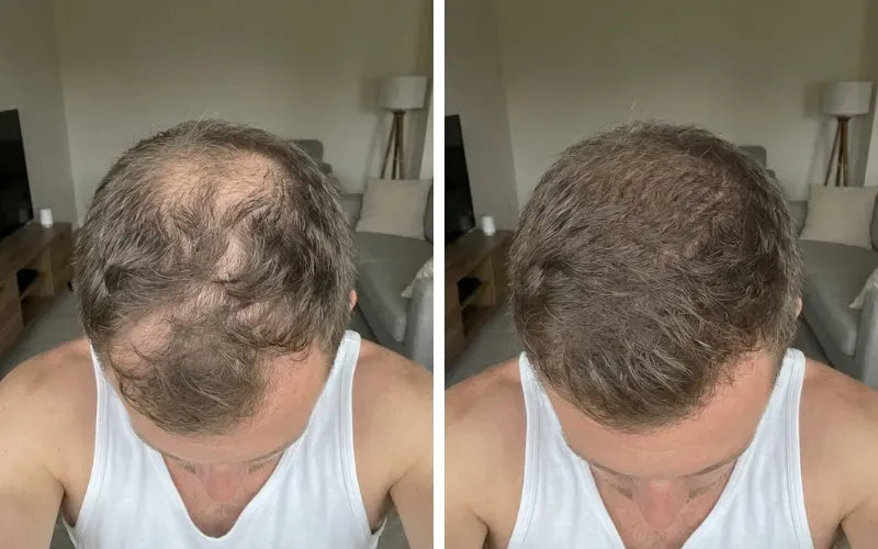 Jason M., 42 before and after