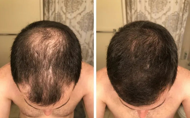 Kevin P., 33 before and after