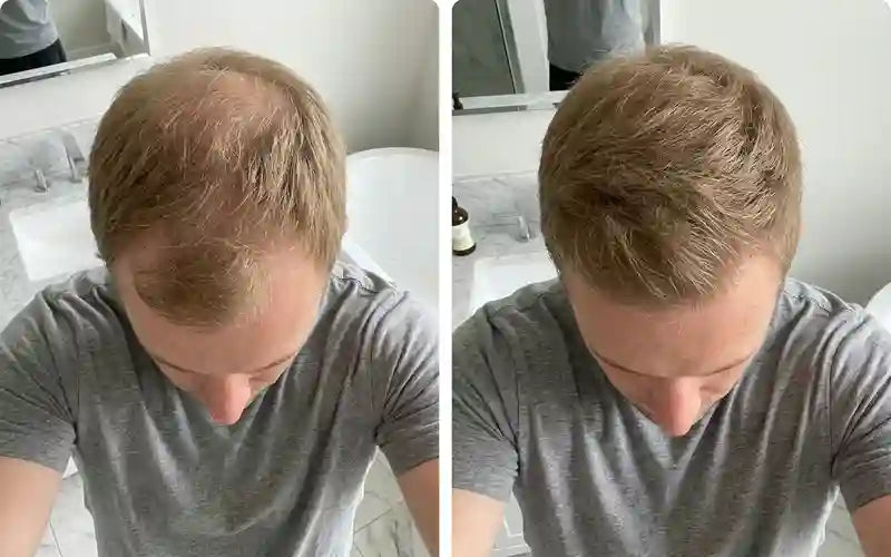 David K., 46 before and after