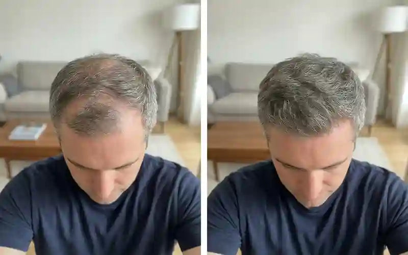 Robert M., 51 before and after