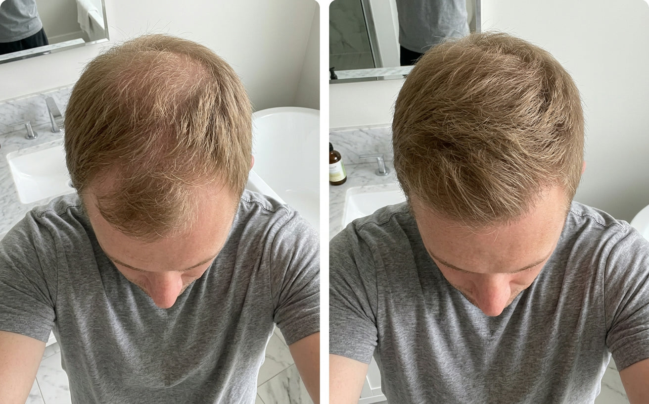 David K., 46 before and after